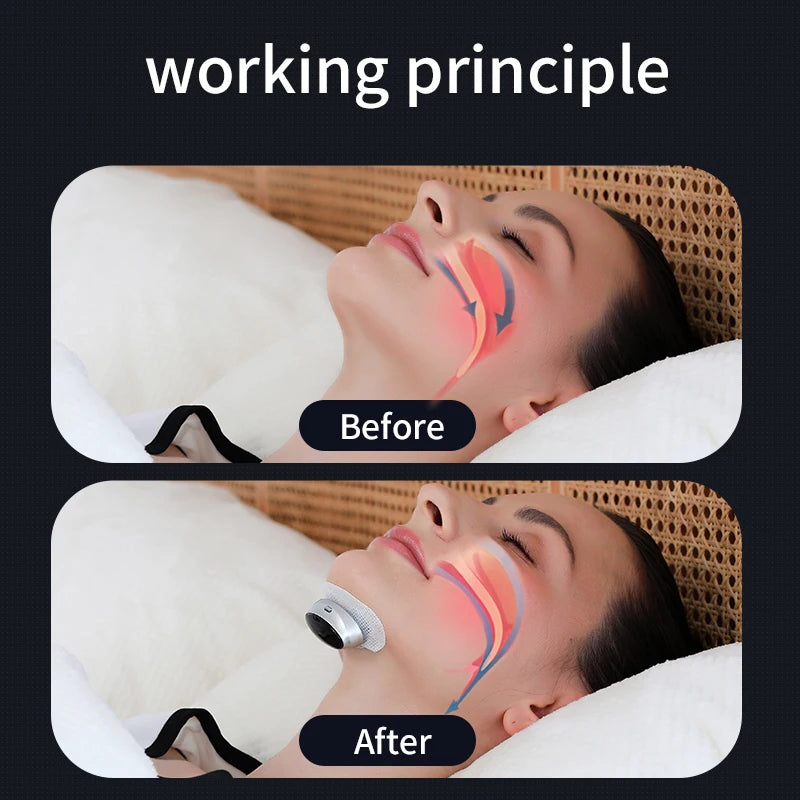 Quiet-Nest Device with Dual-Pulse Stimulation - Sleep Apnea Relief, Snore Reduction,  Muscle Trainer for Silent Night