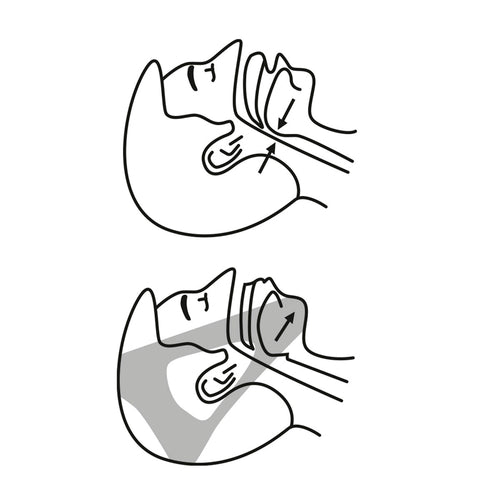 QuietNest™ Anti-Snore Chin Strap